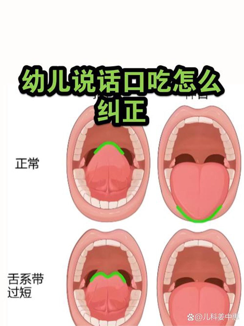 口吃问题如何解决:一场无声的沟通之旅
